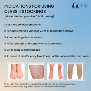 Sorgen Royale (Microfiber) Extra Soft Superior Fabric Medical Compression Stockings for Varicose Veins Class 2 Thigh Length in Eco-Friendly Zip Pouch